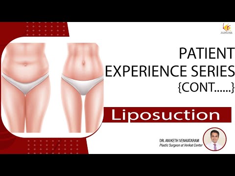 Body Fat Removal Surgery | Liposuction Surgery India | Venkat Center