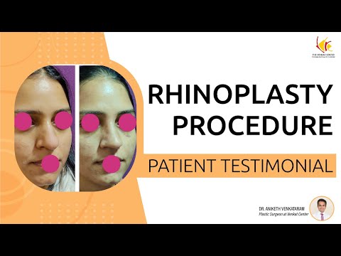 Nose Job Surgery: Real Stories and Reviews from Rhinoplasty Patients - Venkat Center