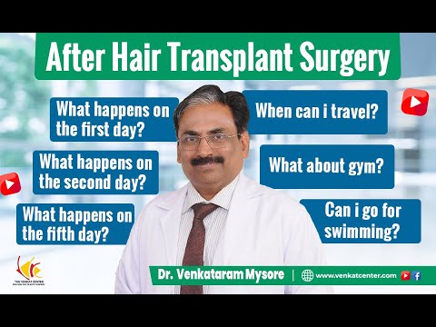 7-Day After Hair Transplant Journey | What to Expect in the First Week | Venkat Center Bangalore