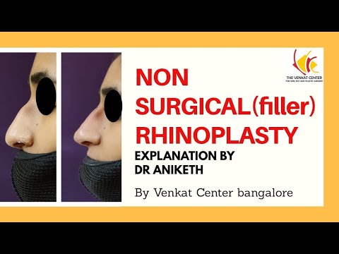 Non-Surgical Rhinoplasty for Nose Job Correction|Real Procedure &amp; Patient Review|Results in Minutes!