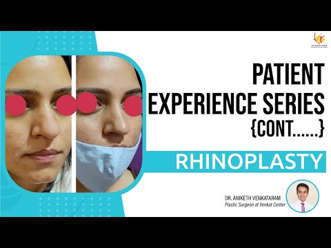 Nose Surgery Reviews | Rhinoplasty Surgery in Bangalore | Venkat Center