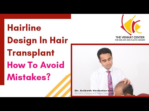 5 Key points for good Hairline Design for Hair Transplantation