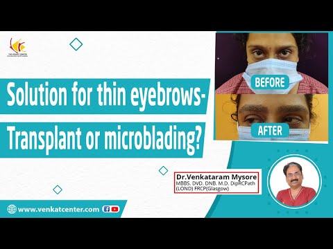 Eyebrow Transplantation in India | What is Microblading? | Eyebrow Tattoo | Venkat Center