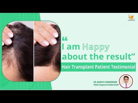 Hair Transplantation Before and After | Hair Transplantation in Bangalore | Venkat Center