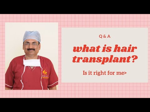 Hair transplant- What is it? (How does it work?). Venkat Center Bangalore