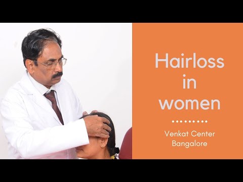 Hair transplant in women (does it work?). Venkat Center Bangalore