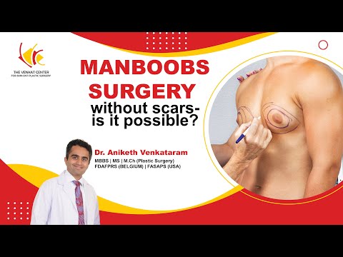 Scarring caused by gynecomastia (Man boobs) procedure |Dr Aniketh Speaks