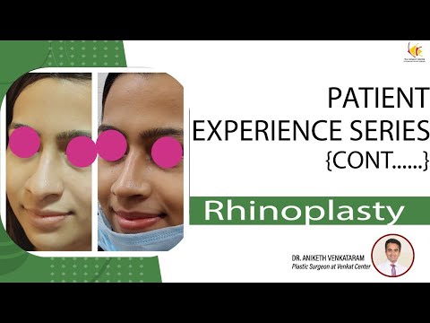 Rhinoplasty Before and After | Nose Reshaping Surgery in Bangalore | Venkat Center