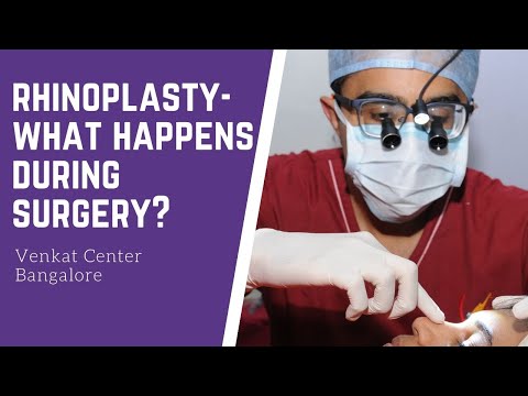 Rhinoplasty- what happens during surgery? (nosejob). Venkat Center Bangalore. India Plastic Surgery
