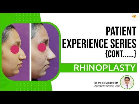 Best Rhinoplasty Surgery in India | Nose Reshaping Surgery | Venkat Center Bangalore
