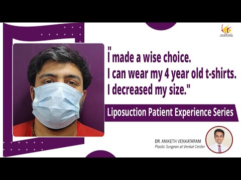 Liposuction Result after 2 Weeks | Liposuction Surgery in India | Venkat Center, Bangalore