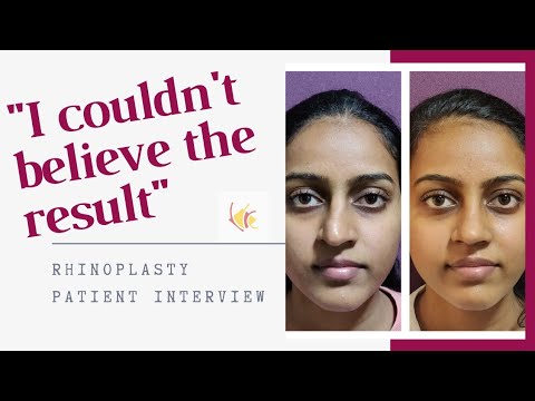 Rhinoplasty Surgery Patient Experience | Best Nose Job Surgery at Venkat Center