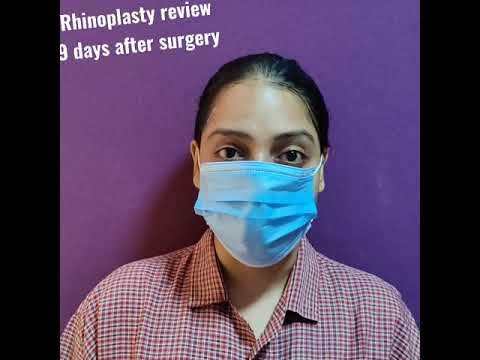 our rhinoplasty patient talks about her experience 9 days after surgery