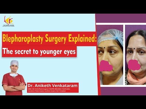 Blepharoplasty Surgery | Eyelid Lift Surgery at Venkat Center