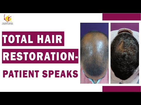 Patient Interview : Hair Transplant