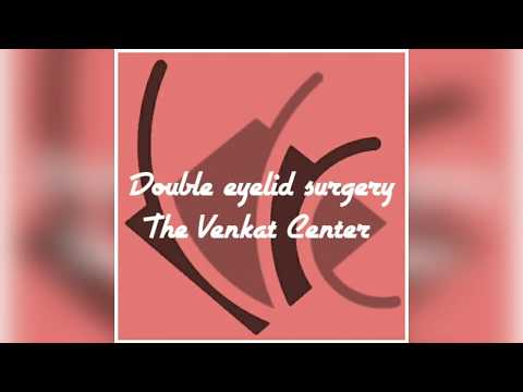 Double eyelid surgery | Asian blepharoplasty | The Venkat Center Bangalore India