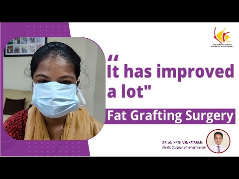 Fat Grafting For Pigmentation | Best Fat Transfer Surgery in India | Venkat Center