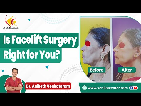 Facelift: Procedure and Benefits | Anti-Aging Surgery in India | Venkat Center Bangalore