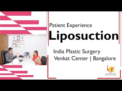 Patient experience - liposuction | India plastic surgery | Venkat Center Bangalore