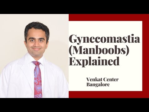 Gynecomastia (manboobs)- what causes it? How to treat?. Venkat Center Bangalore. India Liposuction