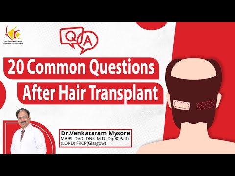 20 Frequently Asked Questions After Hair Transplant | Best Hair Transplant, Venkat Center, Bangalore
