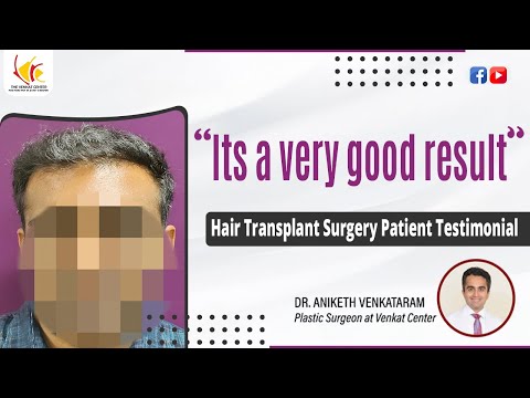 Hair Transplant Surgery Patient Review | Hair Transplant at Venkat Center, Bangalore
