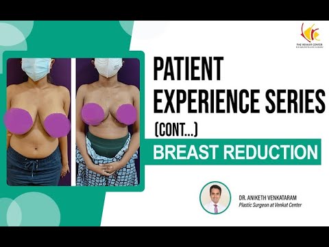 Breast Reduction Surgery Reviews | Breast Reduction Surgery in India | Venkat Center