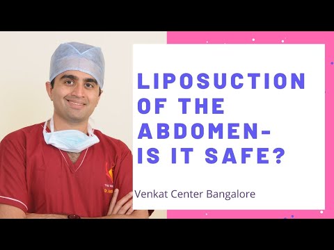 Tummy liposuction (abdomen)- Is it right for me? India Liposuction. Venkat Center Bangalore