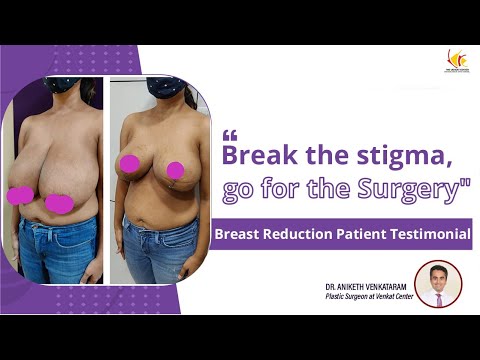 Breast Reduction Surgery Experience | Breast Size Reduction Treatment | Venkat Center
