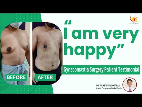 Gynecomastia Surgery Results | Man Boobs Surgery in Bangalore | Venkat Center