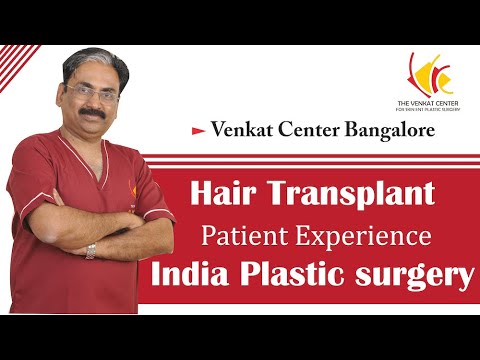 Hair transplant patient experience | Venkat Center Bangalore | India plastic surgery