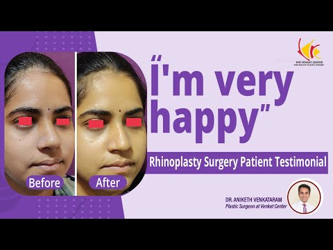 Nose Job Patient Experience | Rhinoplasty Surgery Before and After | Venkat Center Bangalore
