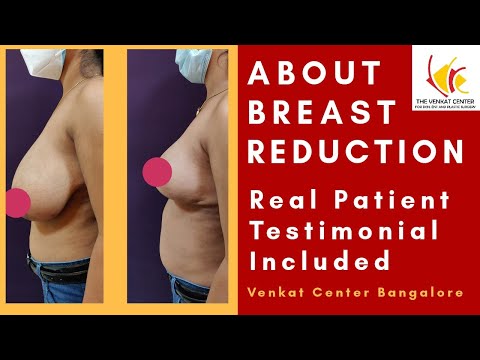 Breast Reduction Surgery| What to expect| Patient Testimonial|Benefits of Breast Reduction Explained