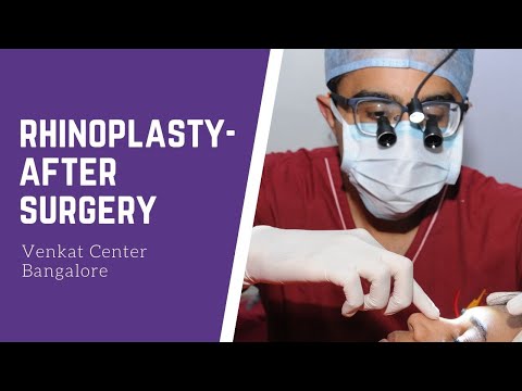 Rhinoplasty- what happens after surgery? (nosejob). Venkat Center Bangalore. India Plastic Surgery