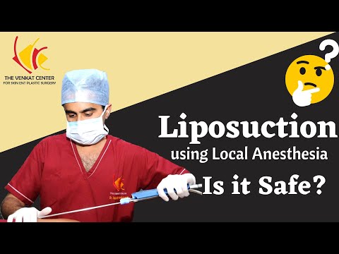 Benefits of undergoing Liposuction using Local Anesthesia (Is it Safe?)