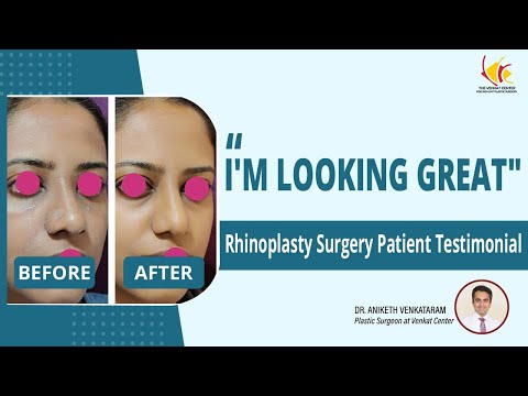 Wide nose tip rhinoplasty in Bangalore | nose job Surgery Experience | Venkat Center