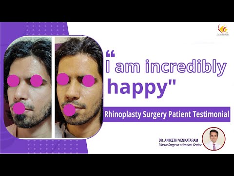 Rhinoplasty Experience | Nose Job in India | Venkat Center