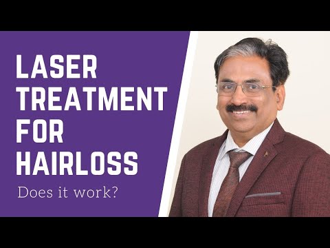 Laser treatment for hairloss- What is it? (laser comb). Venkat Center Bangalore