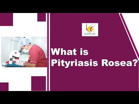 What is Pityriasis Rosea?