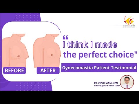 Gynecomastia Surgery Reviews | Man Boobs Surgery at Venkat Center