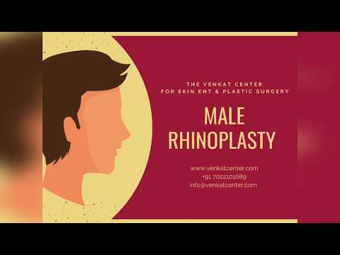Patient Sharing Rhinoplasty Surgery Journey | Venkat Center Bangalore