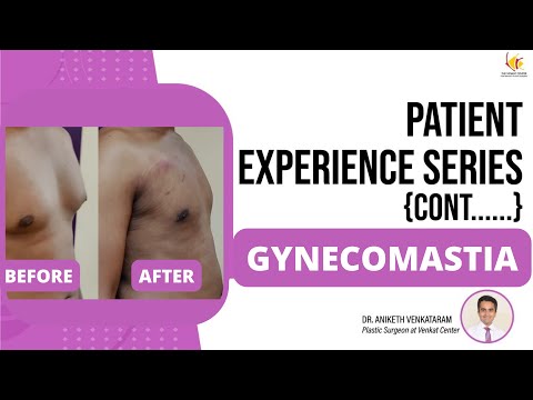 Male Breast Reduction Surgery | Gynecomastia Surgeon in Bangalore | Venkat Center
