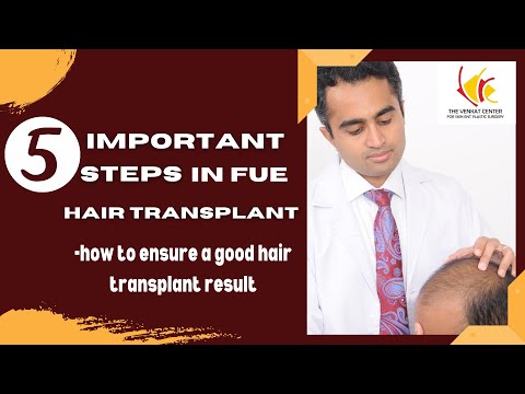 FUE Hair Transplantation (Follicular Unit Extraction) Technique : 5 Important Steps