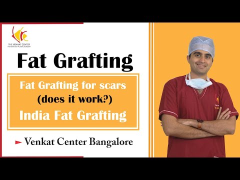 FAT grafting for scars (does it work?) Venkat Center Bangalore. India fat grafting