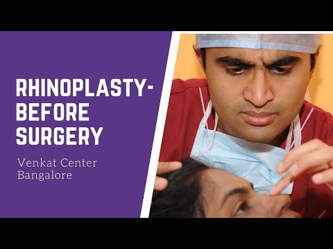 Rhinoplasty- what happens before surgery? (nosejob). Venkat Center Bangalore. India Plastic Surgery