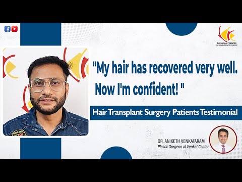 Hair Transplant Surgery Patient Sharing his Experience | Venkat Center Bangalore