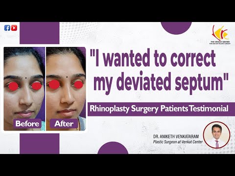 Nose Job - Before and After Experience | Rhinoplasty Surgery at Venkat Center, Bangalore