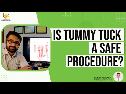 Abdominoplasty Explained in simple terms | View actual results of tummy tuck procedure
