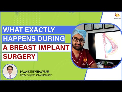 Breast implantation surgery | Walkthrough On the procedure with before &amp; after images