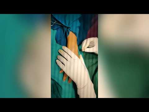 Hand rejuvenation fat grafting| India plastic surgeon | Venkat Center Bangalore